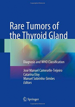 Rare Tumors of the Thyroid Gland