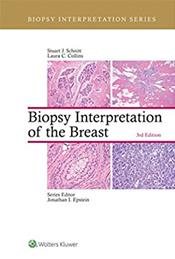 Biopsy Interpretation of the Breast, 3e