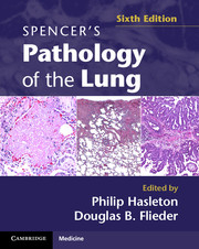 Spencer's Pathology of the Lung 2 Part Set