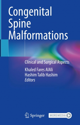 Congenital Spine Malformations