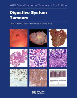 WHO Classification of Tumours - Digestive System Tumours. 5th Edition