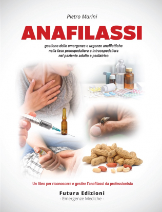 Anafilassi
