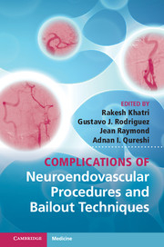 Complications of Neuroendovascular Procedures and Bailout Techniques