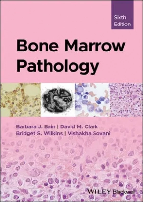 Bone Marrow Pathology, 6th Edition