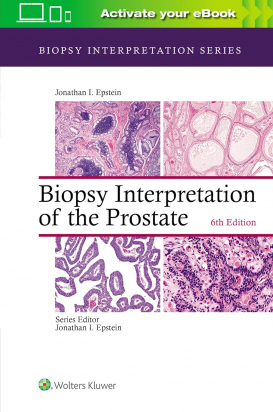 Biopsy Interpretation of the Prostate Sixth edition