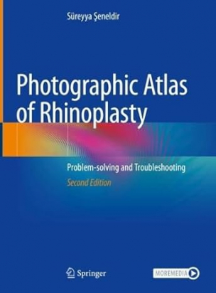 Photographic Atlas of Rhinoplasty ---in uscita