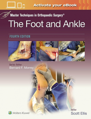 Master Techniques in Orthopaedic Surgery: The Foot and Ankle 4th edition Print + eBook with Multimedia