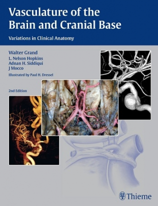 Vasculature of the Brain and Cranial Base