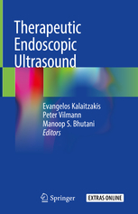 Therapeutic Endoscopic Ultrasound