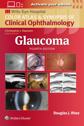 Glaucoma, Fourth edition