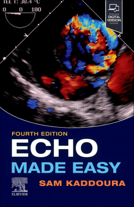 Echo Made Easy, 4th Edition