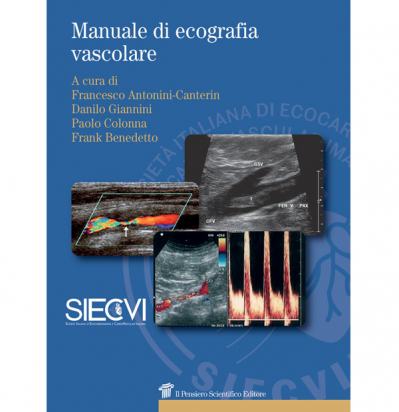 Manuale di Ecografia vVscolare