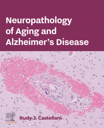 Neuropathology of Aging and Alzheimer’s Disease