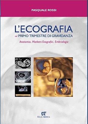 L'Ecografia nel Primo Trimestre di Gravidanza