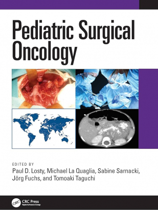 Pediatric Surgical Oncology