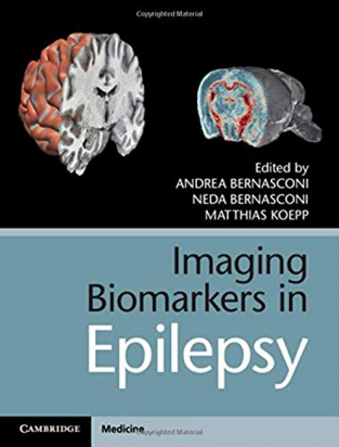 Imaging Biomarkers in Epilepsy