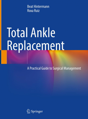 Total Ankle Replacement