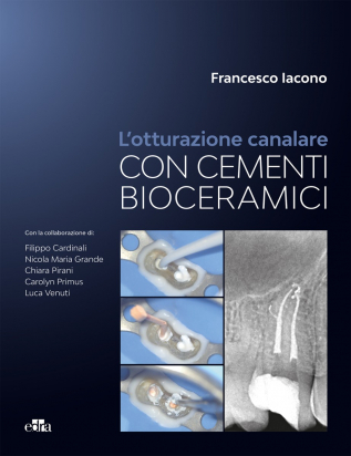 L'Otturazione Canalare con Cementi Bioceramici