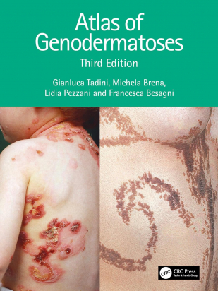 Atlas of Genodermatoses 3rd edition - copertina rigida