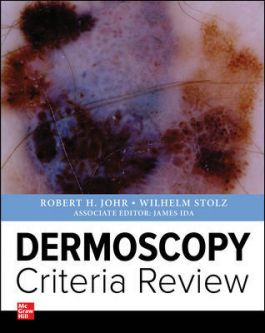 Dermoscopy Criteria Review