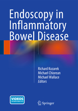 Endoscopy in Inflammatory Bowel Disease