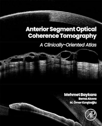 Anterior Segment Optical Coherence Tomography