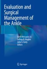 Evaluation and Surgical Management of the Ankle