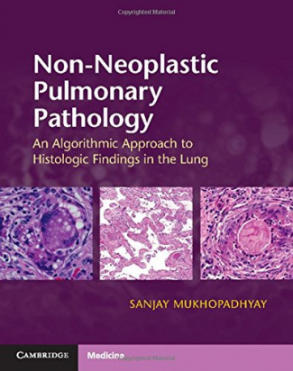 Non-Neoplastic Pulmonary Pathology