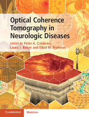 Optical Coherence Tomography in Neurologic Diseases