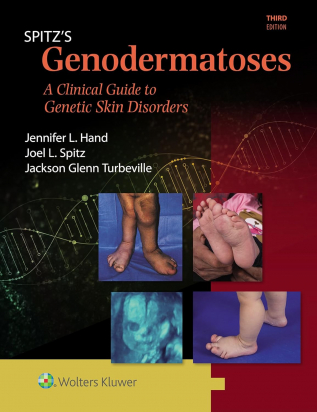 Spitz's Genodermatoses 3rd edition