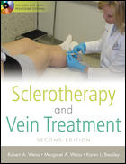 Sclerotherapy and Vein Treatment