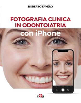 Fotografia clinica in odontoiatria con Iphone