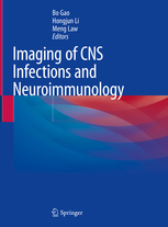 Imaging of CNS Infections and Neuroimmunology