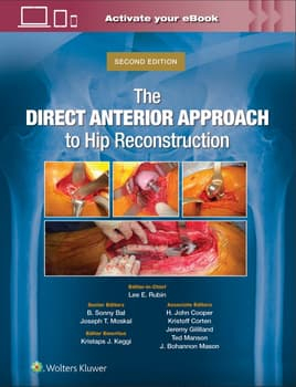 The Direct Anterior Approach to Hip Reconstruction 2nd edition