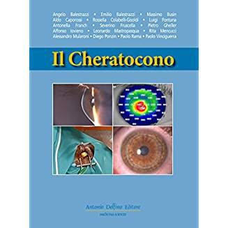 Il Cheratocono