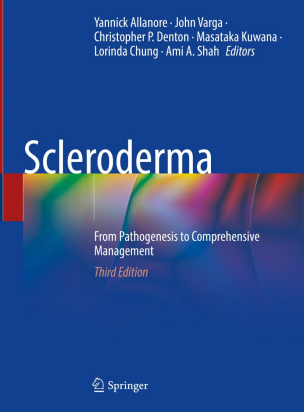 Scleroderma 3rd edition