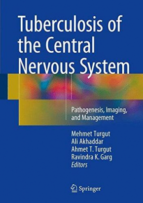 Tuberculosis of the Central Nervous System