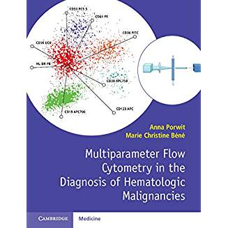 Multiparameter Flow Cytometry in the Diagnosis of Hematologic Malignancies