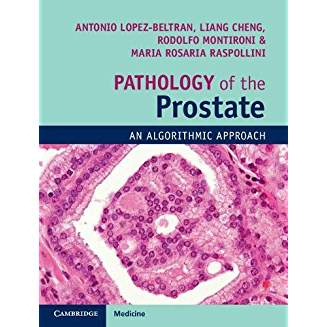 Pathology of the Prostate