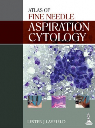 Atlas of Fine Needle Aspiration Cytology