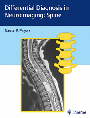 Differential Diagnosis in Neuroimaging: Spine