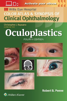 Oculoplastics 4th edition