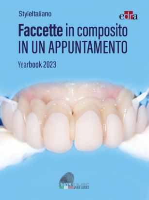 Faccette in composito in un appuntamento - Yearbook 2023