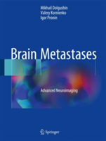 Brain Metastases