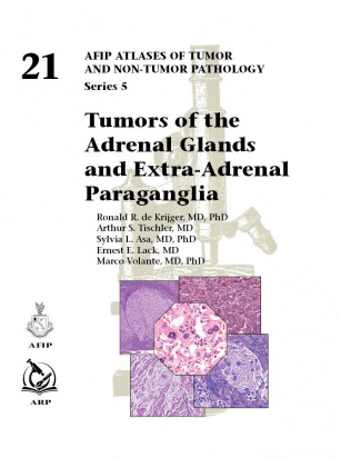 AFIP - FASC. 21- Tumors of the Adrenal Glands and Extra-Adrenal Paraganglia