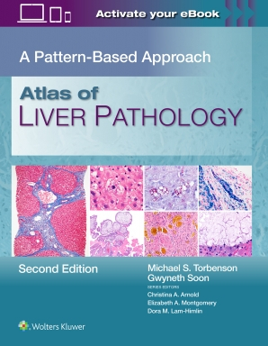Atlas of Liver Pathology, Second edition