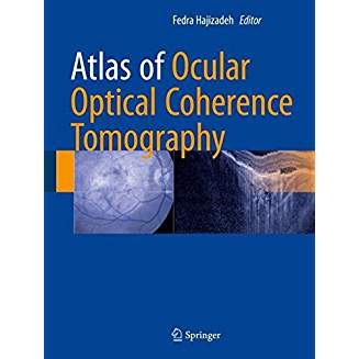 Atlas of Ocular Optical Coherence Tomography