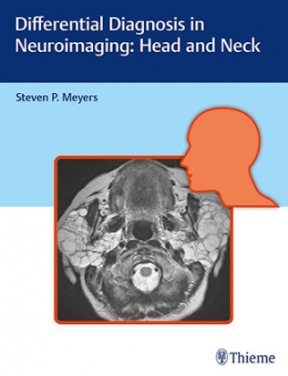 Differential Diagnosis in Neuroimaging: Head and Neck