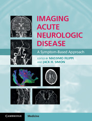 Imaging Acute Neurologic Disease