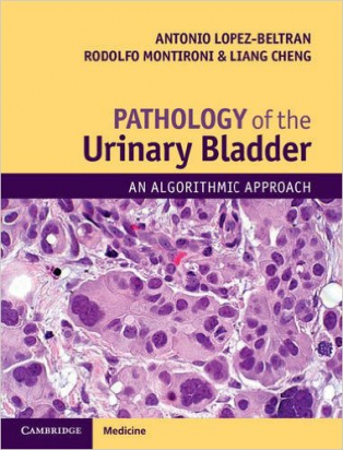 Pathology of the Urinary Bladder